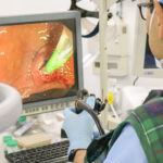 Extracción de cálculos a través de SpyGlass en Clínica Farallones